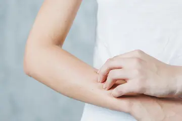 El ve Ayaklarda Uyuşma Hissi