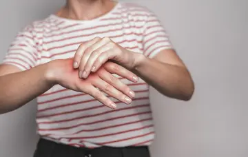 Kuğu Boynu (Swan-Neck) Deformitesi Hakkında Bilinmesi Gerekeneler
