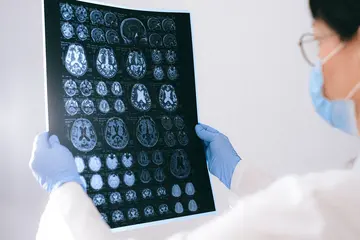 Beyin Tümörü Sonrası Fizik Tedavi ve Rehabilitasyon