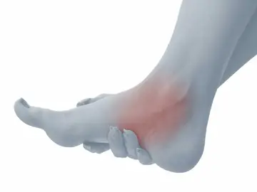 Tarsal Tünel Sendromu Nedir? Neden Olur?