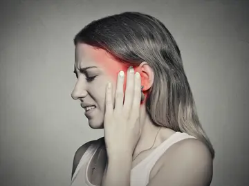 Trigeminal Nevralji