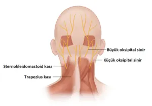 Oksipital Nevralji: Baş Ağrısının Nadir Bir Nedeni