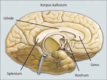 Korpus Kallozum ve Klinik Önemi
