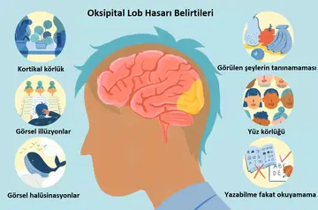 Oksipital Lob Nerededir? Hasarlanırsa Ne Olur?