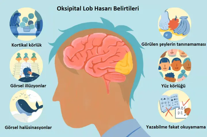 Oksipital Lob Nerededir? Hasarlanırsa Ne Olur?