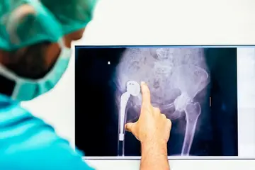 Kalça Protezi Ameliyatı Sonrası Fizik Tedavi