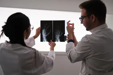 Romatoid Artrite (RA) Neden Olan 5 Faktör