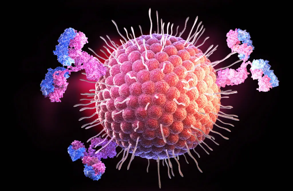 Herpes zoster