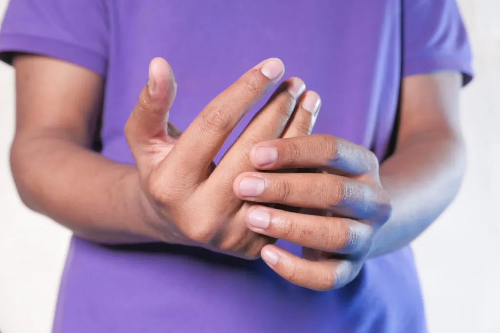 Raynaud Fenomeni Belirtileri Nelerdir?
