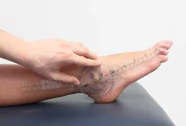 düşük ayak nedir? düşük ayak tedavisi nasıl olur?